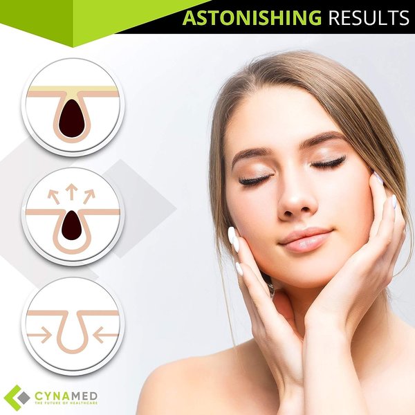 Professional Blackhead Remover Beauty Tw