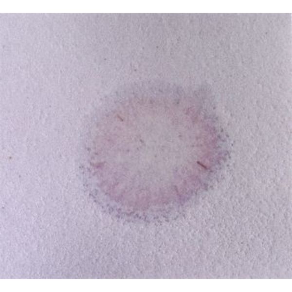 Absorbent Specialty Products Acid Neutralizer Pads