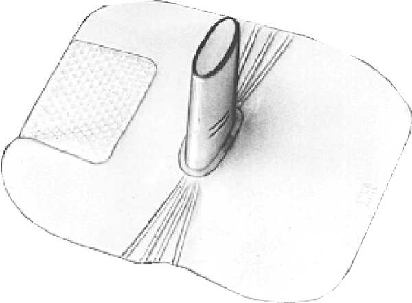 Unitized CPR Filtershield, Vinyl