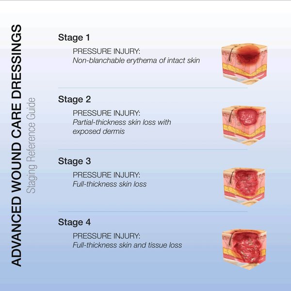 FoamFlex Non-Adhesive Waterproof, PK120