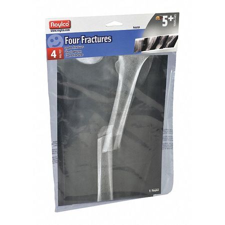 Four Fractures X-ray Sheets,8.5