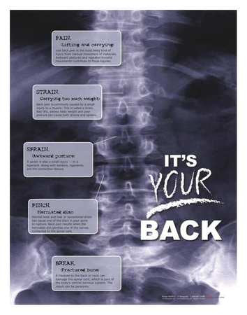 Safety Poster, X-Ray Its Your Back, ENG